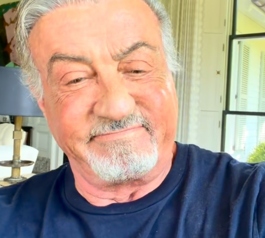 Algunos especialistas han analizado fotografías del actor y han señalado que posiblemente se habría sometido a procedimientos como cirugía de párpados, estiramientos faciales y un posible trasplante de cabello.